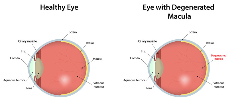 Macula: Anatomy, Function & Common Conditions