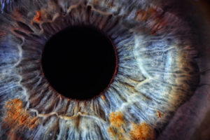 Close-up of an eye after a Lens Exchange