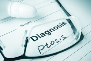 Diagnosis Ptosis Paper